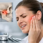 A Practical Guide to Jaw Joint Dysfunction